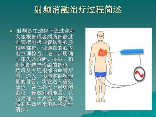 射頻熱凝消融術副作用(射頻熱凝消融術副作用大嗎)