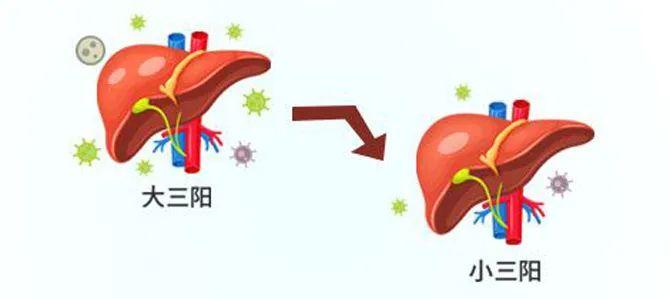 乙肝大三陽癥狀(乙肝大三陽癥狀表現(xiàn))