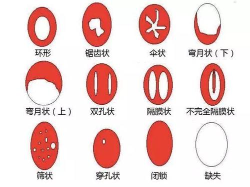 如何解決第一次破處出血？